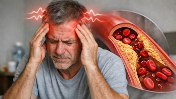 Colesterol y salud cardiovascular: cuándo consultar y cómo manejar valores preocupantes