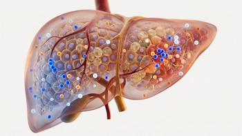 Científicos elaboran el primer mapa molecular del hígado graso: cómo podría cambiar el diagnóstico