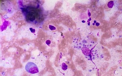 Desarrollan estrategia molecular para mejorar el diagnóstico de las leishmaniasis