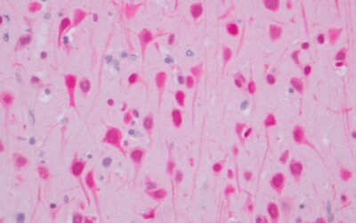 Determinan cómo actúa el virus de la Influenza Aviar H5N1 en mamíferos marinos y confirman su transmisión placentaria