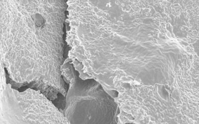 Investigadores del CONICET trabajan en la optimización de un tratamiento contra el glaucoma